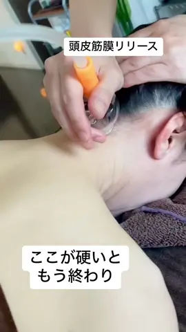 頭痛は現代病とも言われてます 頭が重い頭痛もち、頭が冴えないストレス溜まってる人 是非頭皮リリース試してみてね #頭皮マッサージ #筋膜リリース #ジュラシック筋膜リリース #疲労回復 #スライドカッピング