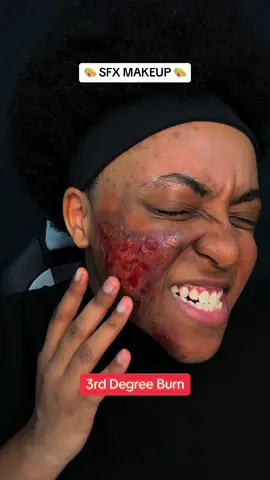 Creating a Fake Burn with Special Effects Makeup‼️ #foryou #sfx #halloween #makeup 