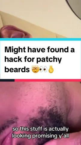 Beard oil 🧐 Rosemary and Castor Oil stay tuned and comment “Patchy” if you want more beard reaults with this product #beardhair #patchybeard #beardgang #hairgrowthtips #facialhair #menhair #beardgrowth #beardgrowthtips 