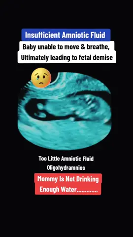 Insufficient amniotic fluid makes the baby unable to move and breathe, ultimately leading to fetal demise#oligohydramnios #amnioticbandsyndrome #amnioticfluid #fluidinwomb #lowwaterinsidewomb #pregnancyultrasoundscan #pregnancyjourney #viraltiktok #viralvideo #12weekspregnant #12weeks 