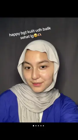 #CapCut #moisturizerviral #ceramidemoisturizer 