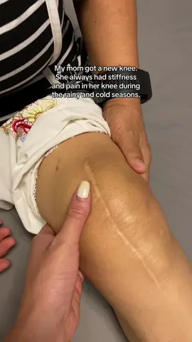She said this made her feel better 🥹 #kneepain #heated #viral #kneemassager #kneeinjury #massager #knie #giftidea #giftformom 