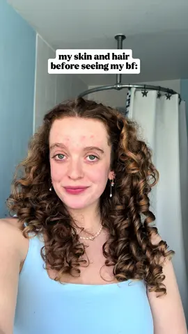 the boyfriend effect. ☠️☠️ I love my bf but I do NOT love the effect he has on my hair and skin 😭 that one bloody pimple hurts SO MUCH #acne #skincare #skin #skinhealth #explore #clearskin #curlyhair 