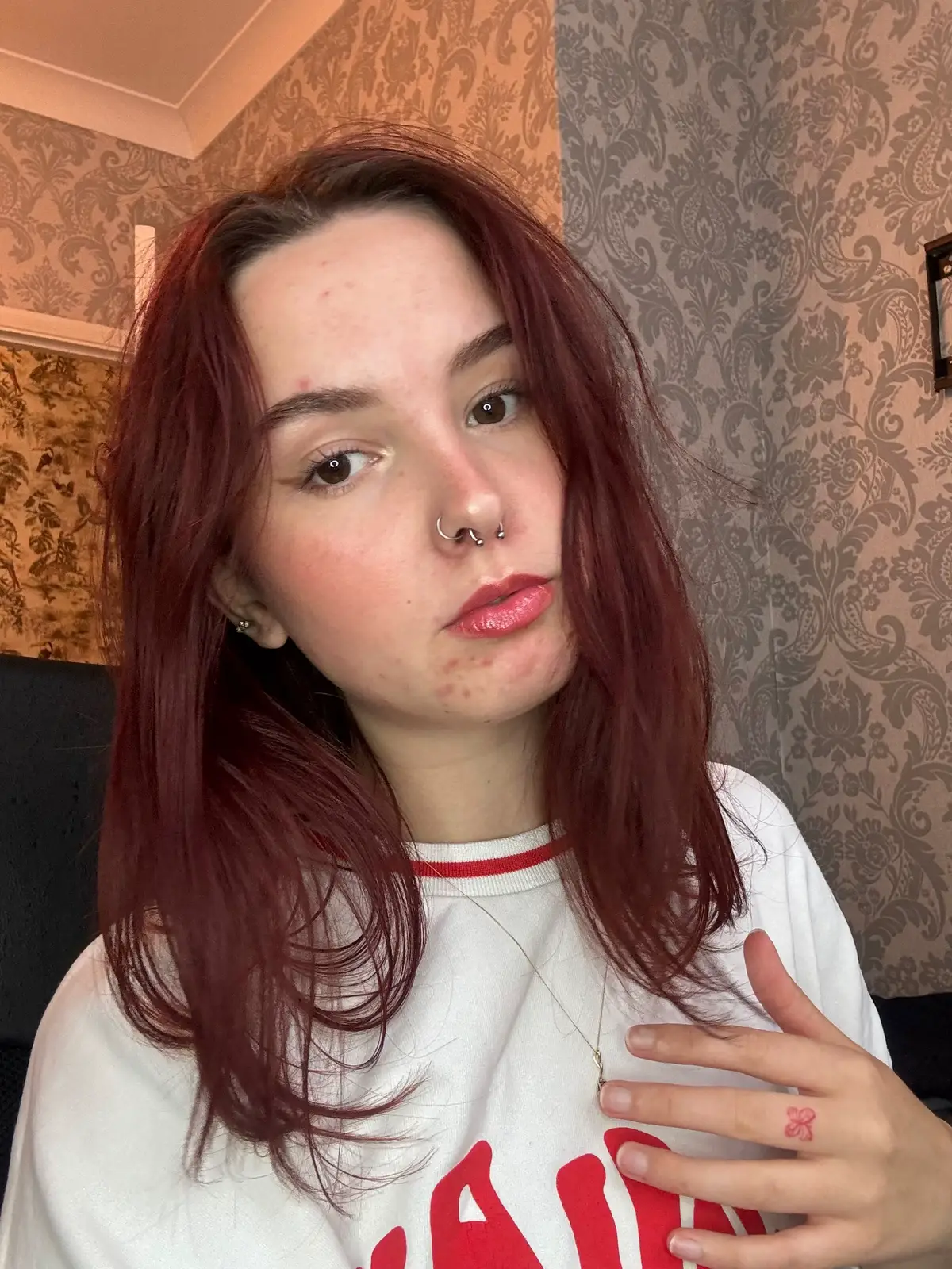 I normally don’t like showing how bad my skin can be, i don’t even like leaving the house however posting has really helped my confidence. Breakouts are normal! I eat alot of junk and sugar so i blame that but i will never change 🫣😅 #breakout #confidence #fyp 