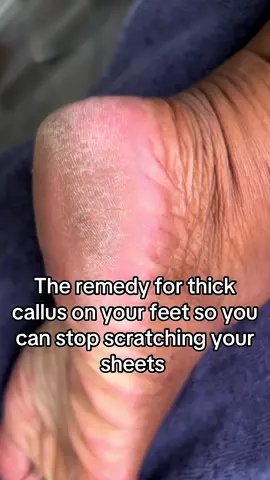 I call it the Sandblaster 3000! This electric foot callus remover is an add to cart moment, in-between pedicures or if you want to just DIY your foot care from now on! Perfect for men & women!  #footcare #pedicure #feet #callus #callusremoval #tiktokshop #beauty #beautytools #beautyfinds #skincare #bodycare #bodycareroutine 