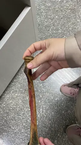 #Upper #limb #bones ( #radius) 🦴 #Anatomy #Skull #greysanatomy #education #medicine #physicaltherapy #dentist