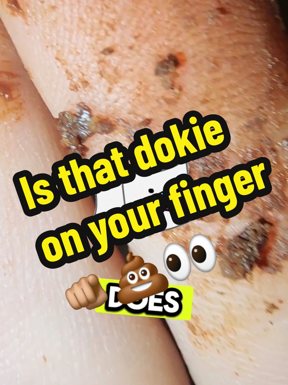 Get the cleanest 🍑 in town.@dudewipes #dudewipes #cleanliness #buttwipes 