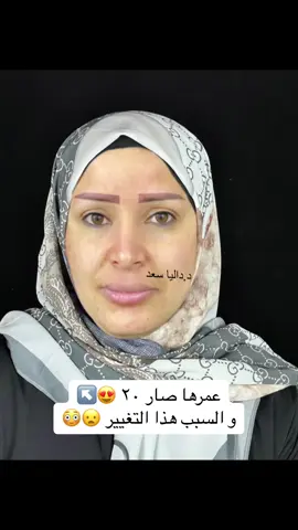 #د_داليا_سعد #الشعب_الصيني_ماله_حل😂😂 #اكسبلورexplore #capcut #رائج #العراق🇮🇶 #تغيير_شامل #حقن #دكتورة #فيلر #انستا #fypシ #محتوى #شفة #عيادات_تجميل #بغداد  