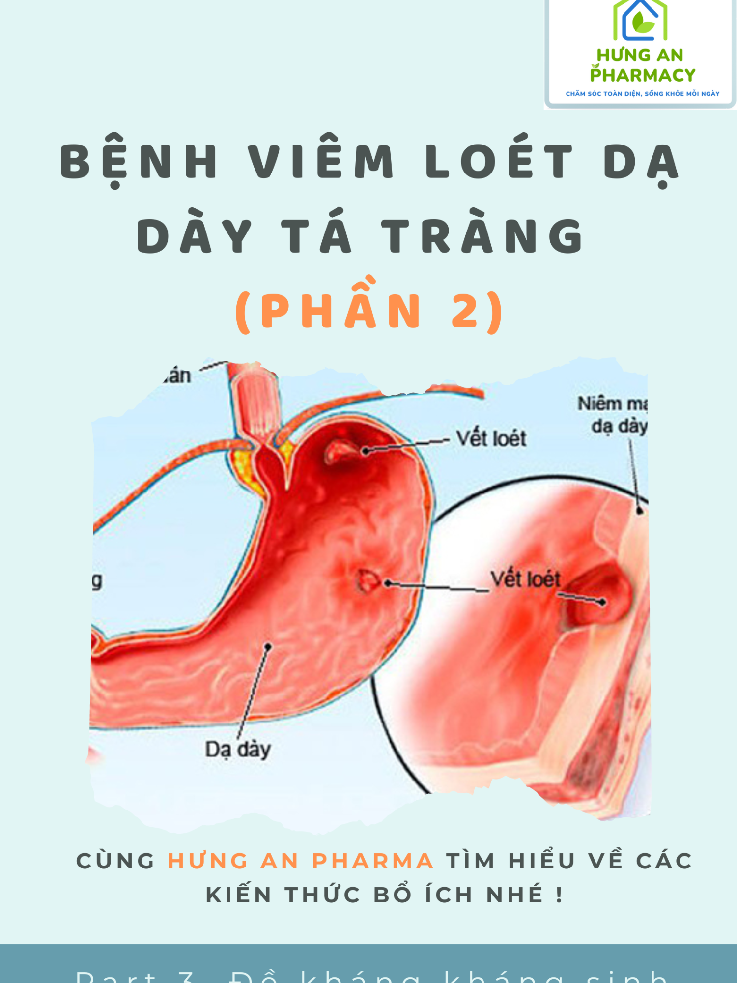 Part 4.2. Bệnh viêm loét dạ dày tá tràng (Phần 2) ---------------------------------------------------- Tìm hiểu cơ chế và nguyên nhân gây ra bệnh viêm loét dạ dày tá tràng và phương pháp điều trị  #suckhoe #stomachache #duocly #duocsi