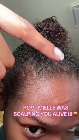 Ive been going through a series of stressful events and thought it was just the stress causing me to lose hair… but then I saw the girlies saying theyre experiencing the same issue. Dry scalp, extremely dry hair, knotted hair, and mass shedding. Yall this like the cherry on top 😭💔💔💔💔💔 #sendhelp #fyp #mielle #miellehairloss #highporosityhair #blackgirltiktokers🤎 