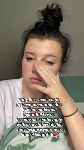 Well they do say sundays the day of rest! #fypage #beauty #nofilterchallenge 