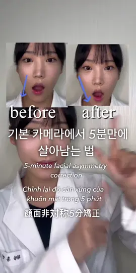 ☑️ 안면비대칭 교정운동  안면비대칭은 턱근육만 제대로 풀어주면 되도록 제자리로 자리가 점저 잡혀가게됩니다👏🏻 하지만, 근육이라고해서 아무근육을 만지는게 아니라 정확한 근육을 만져야합니다.  제일 중요한 포인트 근육은 외익상근 이라는 곳이에요! 만약 영상을 봐도 모르겠으면 댓글 남겨주세요🙏🏻 최대한 자세히 답변드릴게요...! 매일 하루 5set씩 반복해주세요. 어플카메라말고, 기본카메라가 일상이 될때까지 해주는겁니다!!! 꾸준히 해주세요🩷 아 그리고 골반교정운동이랑 같이 적용하면 훨씬 더 효과적이고 유지가 깁니다👏🏻 (제 경험담) - ☑ ️'s facial asymmetry correction movement Facial asymmetry will gradually take place so that only the jaw muscles can be properly relaxed 👏🏻 However, just because it's muscles, you have to touch the exact muscles, not just any muscles. The most important point muscle is the medulla oblongata! If you can't figure it out even after watching the video, please leave a comment 🙏🏻 I'll answer as closely as I can...! Repeat 5 sets a day every day. Not the app camera, but the basic camera until it becomes a daily routine!!! Please do it consistently. 🩷 Oh, and it's much more effective and long-lasting when applied with pelvic correction exercises 👏🏻 (My experience) #셀프마사지 #셀프관리 #얼굴비대칭 #사진빨잘받는법 #셀프성형 #셀프경락 #셀프홈케어 #미용강사 #테라피스트 #한남동스파 #한남동피부관리 #피부강사 #얼굴축소 #펄쌤 #SelfMassage #SelfManagement #FaceAsymmetry #Howtogetgoodphotos #SelfMolding #SelfEnjoy #SelfHomeCare #BeautyInstructor #Therafist #HannamdongSpa #HannamdongSkinCare #SkinInstructor #FaceReduction #PearlTeacher #セルフマッサージ#セルフケア#顔の非対称性#写真の通り抜け方#セルフ整形#セルフ経絡#セルフホームケア#美容講師#テラピスト#漢南洞スパ#漢南洞エステ #皮膚管理 #皮膚講師 #顔縮小 #パール先生 #自我按摩#自我管理#面部不对称#吸收照片的方法#自我整形#自我经络#自我家庭护理#美容讲师#疗愈师 #汉南洞SPA #皮肤讲师 #脸部缩小 #珍珠老师 #自我按摩#自我管理#面部不對稱#吸收照片的方法#自我整形#自我經絡#自我家庭護理#美容講師#療愈師 #漢南洞SPA #皮膚講師 #臉部縮小 #珍珠老師 #Tựmátxa #Tựmátxa #Tựđốixứng #Cáchtựlàmđẹp #Tựlàmđẹp #Tựchămsócbảnthân #Tựchămsóctạinhà #Terafist #ChămsóclàndacủaHannamdong#ChămsóclàndacủacôPearl 