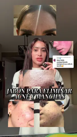 Respuesta a @karen🦋 jabon de aloe vera para eliminar acne y manchas #sabila #acne #eliminargrasa #acne #bajardepesonatural #tips #manchasenlapiel #manchas #manchasenlacara #acne #acneskin #acnetreatment #acneskincareroutine #acnescars #acnejourney #eliminar 