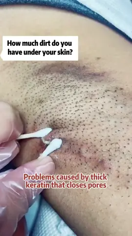 Pengelupasan untuk seluruh badan! Lembut, licin, memutih dan melembapkan semua dalam satu, SHE Eureka Exfoliator kini aktif dengan kupon yang hebat dan penghantaran percuma, jadi cubalah! #sheeureka  #exfoliating  #exfoliatinggel  #skincare  my1239