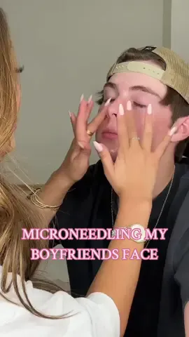 who knew we could do micro needling at home😋 @vtcosmetics_global #SpicySkincare #Glowskin #Microneedling #Homecare #Kbeauty #Koreanskincare #Reedleshot #Vtcosmetics 