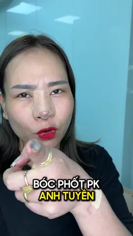 Bóc phốt phòng khám Bs tuyền - A Tuyền xin lỗi em được chưa ❤️#xuhuong #LearnOnTikTok #nangmui #nangmuiphongthuy #nangmuicautruc #nangmuisline 