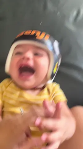 #creatorsearchinsights #babyteeth #ambernecklace  #helmetbaby #babytok #MomsofTikTok #boymom 