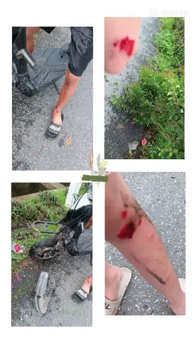 má nó đau thốn thật sự😢