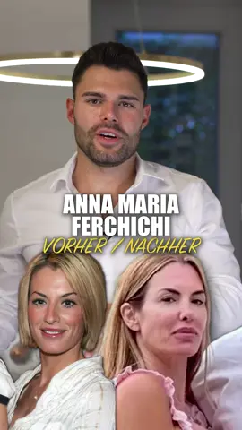 Anna Maria Ferchichi: Früher vs. Heute  _________________ Hinweis: sämtliche Äußerungen in meinen Videos bewerten weder die Person selbst oder deren Optik sondern lediglich die (womöglich) durchgeführten Behandlungen im Hinblick auf Natürlichkeit. #annamariaferchichi #frühervsheute #beautydoc #behandlung #hyaluron #brustop 