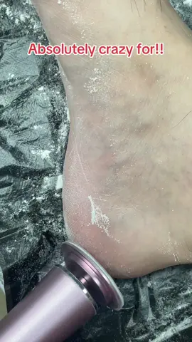 And using this was lowkey very relaxing & therapeutic.No doubt this file is the best and the proof is shown.#foryou #fyp #uk #tiktokmademebuyit #tiktokshop #amazon #creatorsearchinsights #foot #footcaretools #feetcare #callusremover #pedicure #Spotlight #Dealdrops @TikTok @TikTok UK 