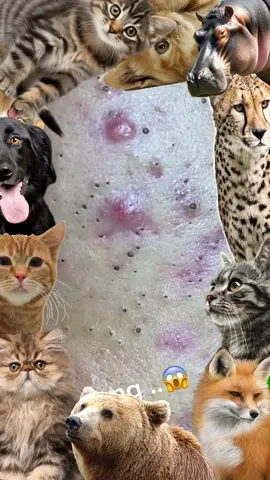 #pimple #Pimple #pimples #pimpleremover #pimplepopper2021 #pimplepopperaddict #pimplepatch #pimpleremoval #pimplepopper2022 #pimples_brufoli #satisfying #Satisfying #satisfyingvideo #satisfyingvideos #satisfyingsounds #satisfyingsound #satisfyingcleans #satisfyingasmr #satisfyingart #satisfyinglips #acne #Acne #acnetreatment #acneskin #acnefighter #acneproneskin #acnescars #acnejourney #acneskincare #acnepatch #Blackhead #blackheads #blackheadsremoval #blackheadsss #blackheadsremover #blackheadsremovalmask #blackheadsextractions #blackheadspopping #blackheadstrip #blackheadsout #blackheadsremove #foryou 
