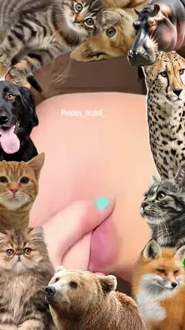 #pimple #Pimple #pimples #pimpleremover #pimplepopper2021 #pimplepopperaddict #pimplepatch #pimpleremoval #pimplepopper2022 #pimples_brufoli #satisfying #Satisfying #satisfyingvideo #satisfyingvideos #satisfyingsounds #satisfyingsound #satisfyingcleans #satisfyingasmr #satisfyingart #satisfyinglips #acne #Acne #acnetreatment #acneskin #acnefighter #acneproneskin #acnescars #acnejourney #acneskincare #acnepatch #Blackhead #blackheads #blackheadsremoval #blackheadsss #blackheadsremover #blackheadsremovalmask #blackheadsextractions #blackheadspopping #blackheadstrip #blackheadsout #blackheadsremove #foryou 