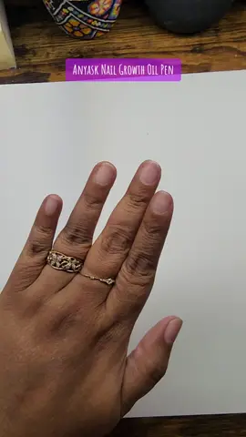 Thank you @Anyask_beauty for allowing me to use and promote your amazing #nailgrowth serum. As anyone can clearly see, my nails need help! I will be using this regular to help my nails become healthier. #nailstrength #Anyask #nailserum #nailstrength #nailtool #Makeuptool #mibolaloca #nailtok 