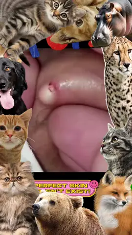 #pimple #Pimple #pimples #pimpleremover #pimplepopper2021 #pimplepopperaddict #pimplepatch #pimpleremoval #pimplepopper2022 #pimples_brufoli #satisfying #Satisfying #satisfyingvideo #satisfyingvideos #satisfyingsounds #satisfyingsound #satisfyingcleans #satisfyingasmr #satisfyingart #satisfyinglips #acne #Acne #acnetreatment #acneskin #acnefighter #acneproneskin #acnescars #acnejourney #acneskincare #acnepatch #Blackhead #blackheads #blackheadsremoval #blackheadsss #blackheadsremover #blackheadsremovalmask #blackheadsextractions #blackheadspopping #blackheadstrip #blackheadsout #blackheadsremove #foryou 