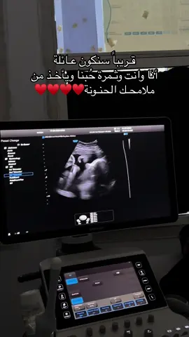 ماشاء الله يـارب يتمم لنـا على خير ويجيبه بالسـلامة ويـقر عيننا♥️♥️. #foryou #fyp #my_love #حب #بيبي #نيو_بيبي #طفلي #سونار 