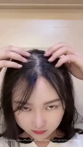 شعر ينمو بسرعة، أكثر كثافة ونعومة بعد بضع استخدامات فقط! هل جربت بخاخ الشعر FEG Plus بعد؟ #fegplus #hair #serum #arab #fyp #haircare  