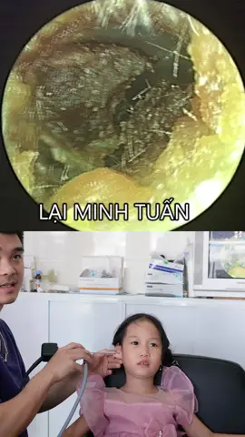 Làm sạch tai cho 2 chị em mặc váy công chúa giống nhau #xuhuongtiktok #xuhuong2024 #laiminhtuan #layraytaicocamera #layraytaichobe