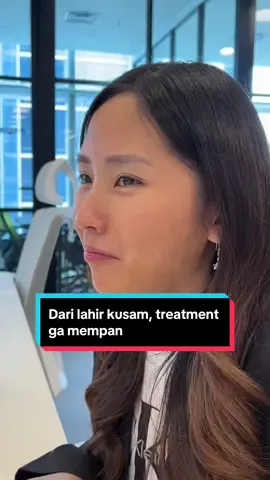 Siapa yang sama kaya aku? Dari lahir kusam sampe treatment pun ga mempan 😫 #facemask #glassskin #fyp #skincaretips #skincarehacks #glowing #skinjourney 