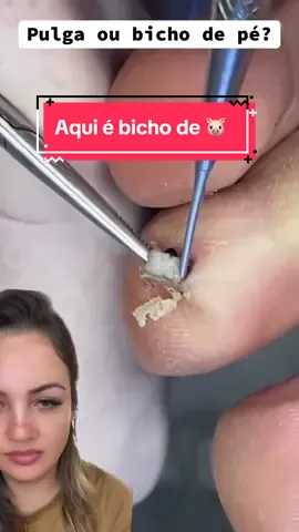 Deixe um comentario ##satisfatório #terapia #limpezasatisfatoria #reagindo #bichodepe 