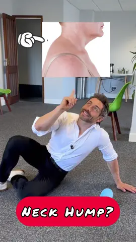 How to fix neck hump and dowager’s hump. #dowagershump #neckhump 