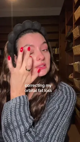 day 1 using volufiline to correct orbital fat loss                                              #volufiline #orbitalfatloss #lashserum #grandelash 