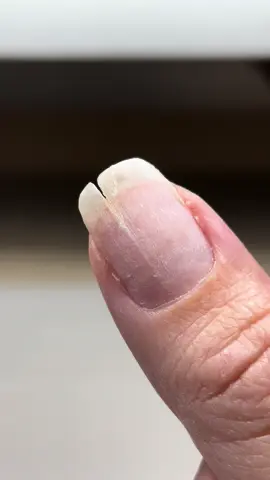 I know it’s ugly af 🥹 watch me repair this damaged nail using a teabag! Hope this helps! #nailtech #nailtechlife #naileducation #nailrepair #nails 