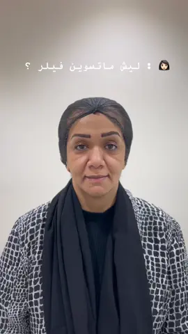 د/ايمــــان فتوح 👩🏻‍⚕️💉 . . #فيلر_طبيعي #فيلر_الوجه #حقن_الفيلر #بوتكس_تجاعيد #بوتكس_تجاعيد #هشتاق #الرياض #explorer #explorepage #viraltiktok #fy #foryou #عيادات_تجميل #الشعب_الصيني_ماله_حل😂😂 