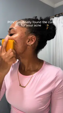 Once you start using this soap you'll never go back, the original creator ✨#turmericsoap #turmericsoapbar #hyperpigmentation #skincare#skincaretips #SkinCare101 #pov #viral_video #darkspots 