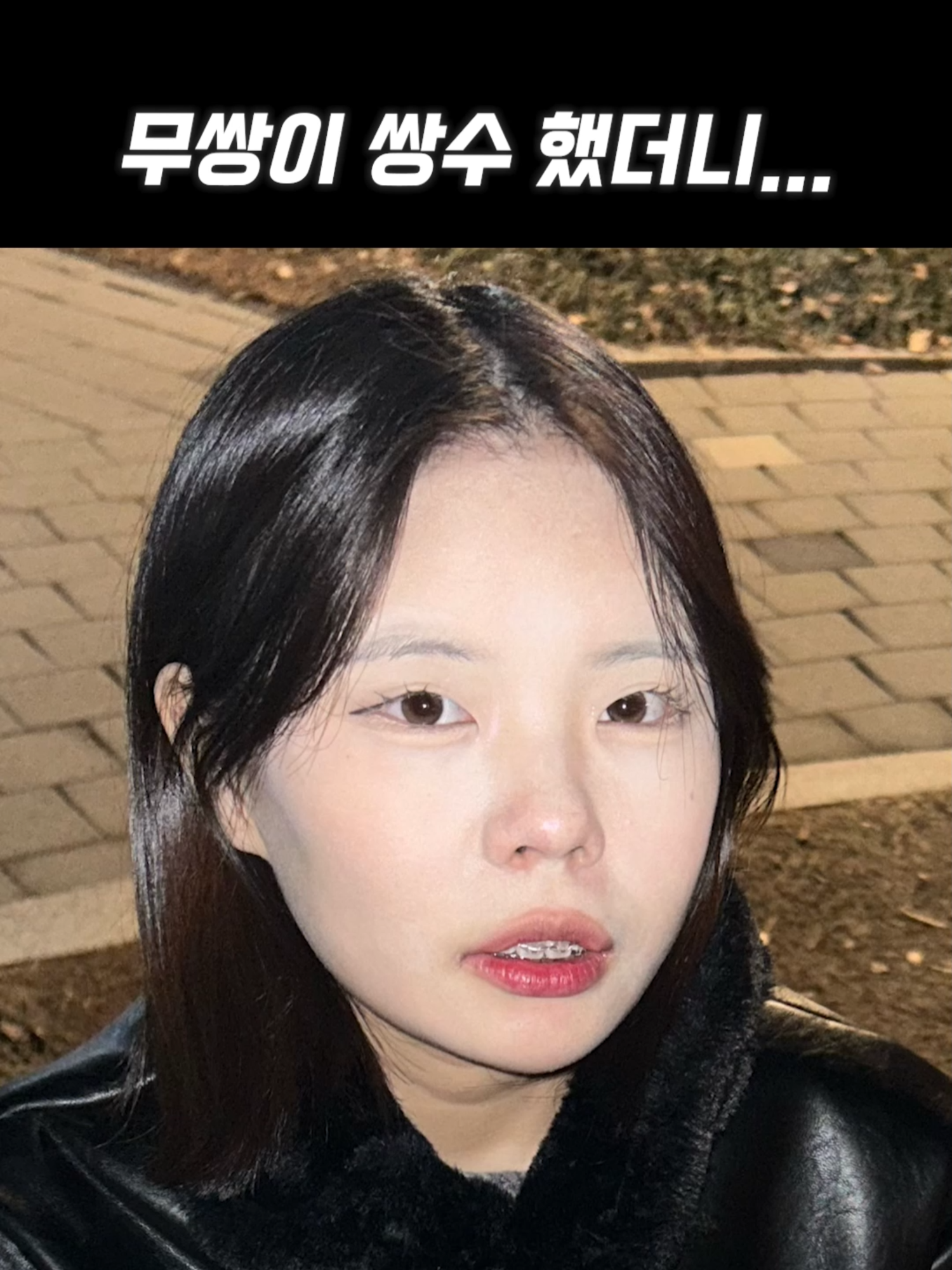 무쌍이 쌍수하면?? #fypシ゚ #viraltiktok #koreanskincare #20 #eye#beforeafter