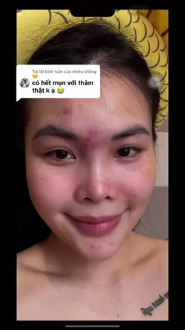 chỉ cần biết cách, ai rồi cũng sẽ xinh đẹp nha chị em #beuacnes #trimun #skincaretips #fyp