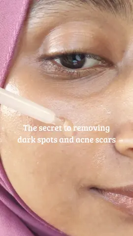 ✨ Torriden Cellmazing Brightening Ampoule ✨: @𝗧𝗼𝗿𝗿𝗶𝗱𝗲𝗻 토리든  1. Quick Absorbing Formula:  Lightweight and non-greasy, perfect for layering into my skincare routine. 2. Brightening Boost:  The Vitamin C5 Complex helps with brightening and fading blemishes for a more radiant complexion. 3. Blemish Toning:  This ampoule  helps even out skin tone, targeting stubborn blemishes and dark spots. 4. Hydrating Power:  Leaves skin feeling plump and hydrated throughout the day. 5. Gentle on the Skin:  Perfect for all skin types; no irritation or stinging after use. A perfect glow-up in a bottle! ✨ . . . . . #torriden #skincare #cellmazing #vitaminc  #skincareroutine #ampoule #darkspotsremover #brighterskin #koreanskincare #Kbeauty 	#softgirlbeauty 	#skincareessentials #ugcvideo 	#videocreator 	#viral #trending #fypシ  . . . . . . . . Torriden. Cellmazing. Vitamin C. Ampoule. Brightening. Glow up. Korean Skincare. KBeauty. UGC. Creative. Video. Content. Product review. Lightweight. Soft girl aesthetics. Glowy Skin. Viral. Trending. FYP. 