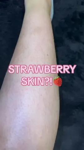 Replying to @aza You asked, i delivered 🤗. Here’s my very effective routine that got rid of my strawberry skin (Keratosis Pilaris) #keratosispilaris #kpbumps #strawberrylegs #skincaretips #skincareroutine #viralskincare #skintok #glytone #glycolicacid #bodyretinol #clearskin
