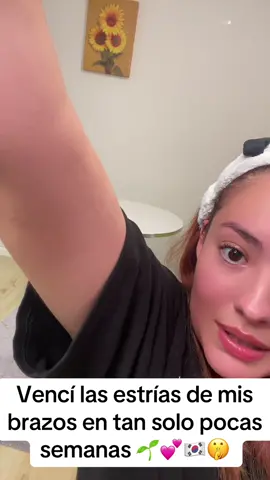 Puedes vencer las #estrias de tus brazos o de cualquier parte del cuerpo usando cremas que contengan centella asiatica  Agradecida por siempre connel creador de #NIDA mi piel se ve radiante ahora !!  #pielbonita #pielperfecta #pielsana #estriasembarazo #estriaschallange #koreanskincare 💕🌱☀️