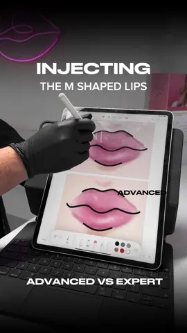 Comparing advanced and expert techniques for the m-shaped lips 🩷✔️ To get more insignts on injecting complex lip shapes - find the full lesson on my instagram subscripton💉 #lipfillers #russianlipsuk #flatlips #flatlipsuk #russianlipstechnique #flatlipstechnique #lipfillerstraining #russianlipstraining #russianlipslondon #russianlips💉