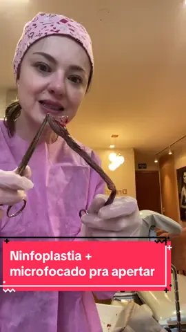 Aperta muuuuiiitoooo #ninfoplastia #cirurgiaplastica #ginecologia 