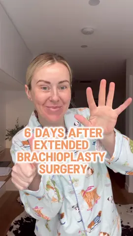 ☝🏼✋🏼 DAY 6 POST OP • Bruises are changing from a lovely shade of purple to yellow.  • Itchiness is persistent - I have literally given myself wounds on my chest from scratching during my sleep. I CANNOT STOP.  • The swelling is restricting my mobility.  • Slowly reducing / weaning off pain killers.  • Becoming more independent.  • Mum calls me 10 times a day to tell me to go to bed and rest. • Officially watched more TV in the last week than I have all year.  #brachioplasty #extendedbrachioplasty #armlift #extendedarmlift #weightloss #beforeandafter #surgeryafterweightloss #surgerytiktok #excessskinremoval #excessskin #transformation #plasticsurgeon #plasticsurgeonsoftiktok 