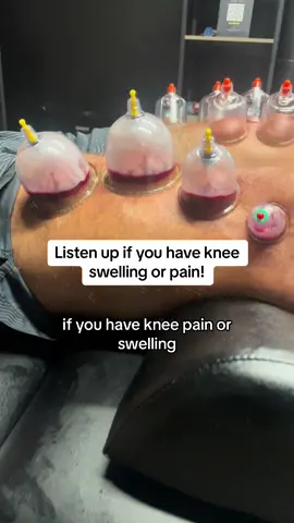 This knee massager is crazy! #kneepain #massagetherapy #kneemassager #massage 