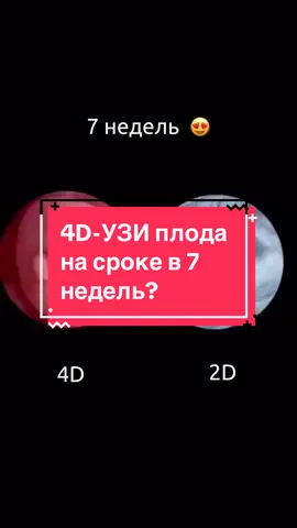 Как выглядит плод в 7 недель на 4D УЗИ?👶 #беременность #интересное #эмбрион #статьмамой #родители #малыши #малышимама #любовь❤ #дети #малышня #аборт #биология 