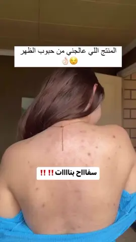 غسول بانوكسيل