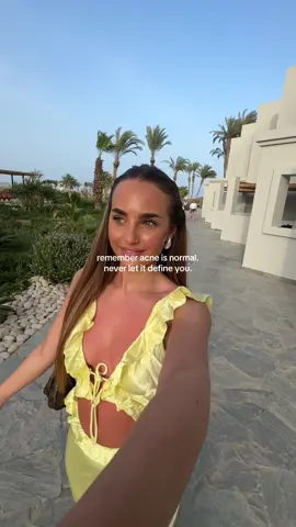 the perfect skin doesn’t exist. never let your spots/acne dull your sparkle 💫  inspo: @Sophie Dove  #acnestruggles #skintok #acneproneskin #girlythings 